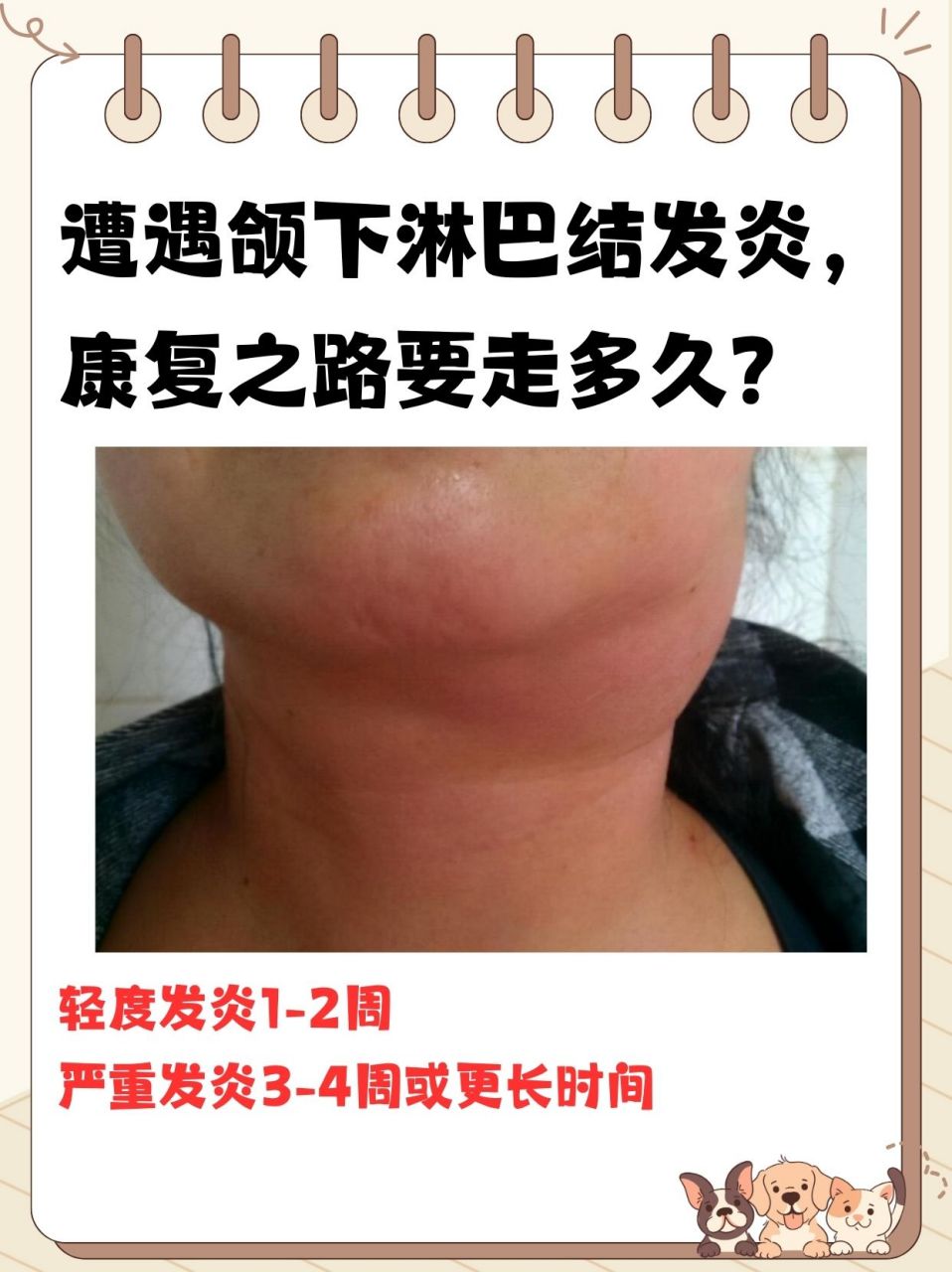 遭遇颌下淋巴结发炎,康复之路要走多久?