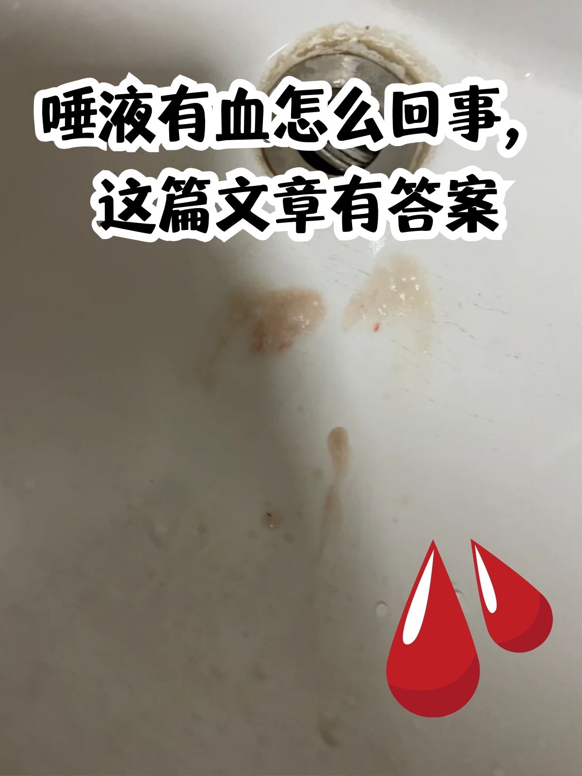 口腔出血的照片图片