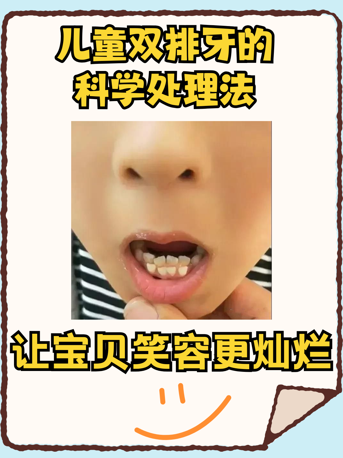 儿童双排牙的科学处理法,让宝贝笑容更灿烂 双排牙,医学上称为乳牙