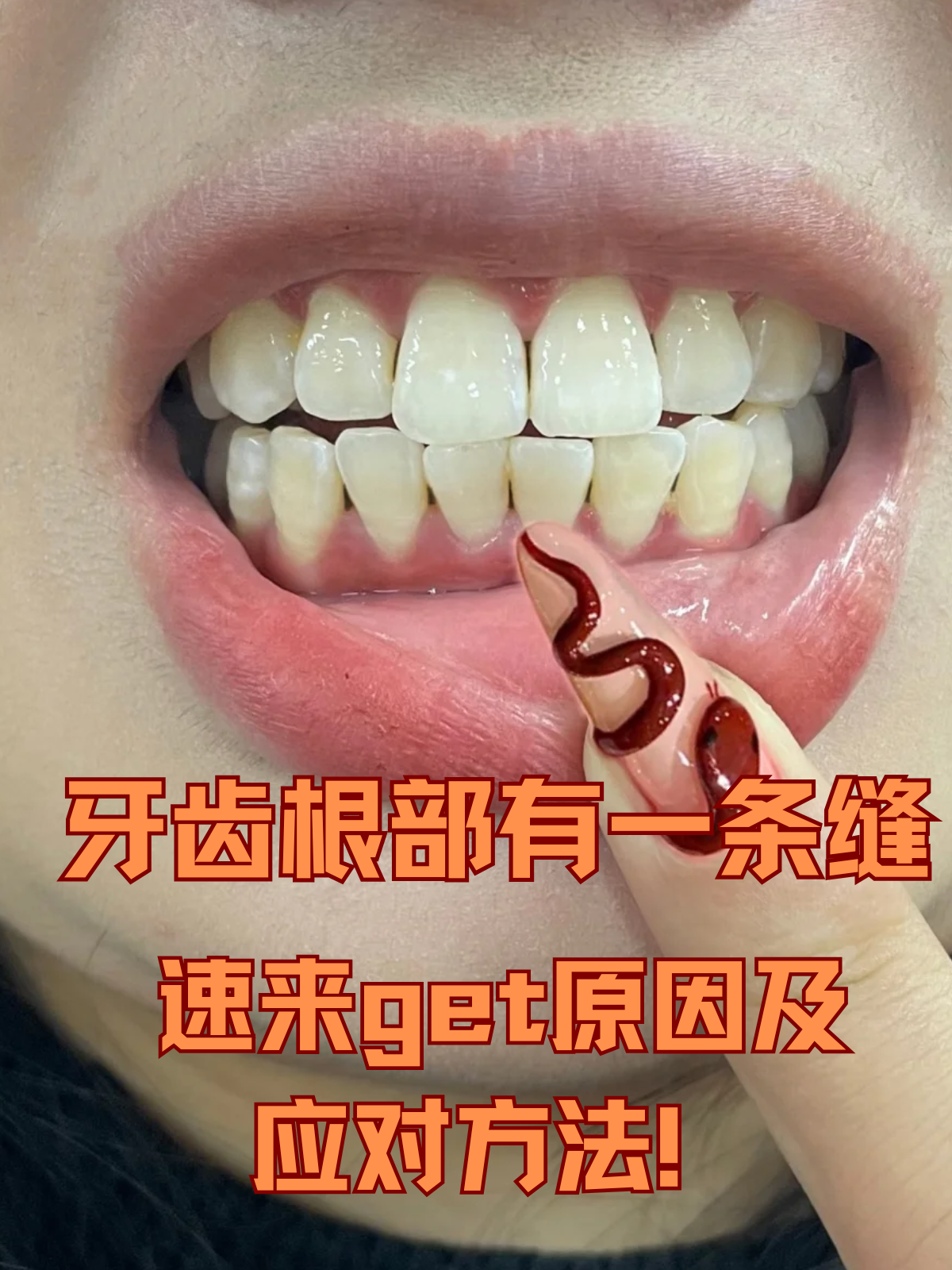 照镜子时,突然发现牙齿根部竟然有一条细细的缝,这好好的牙齿,怎镁屯