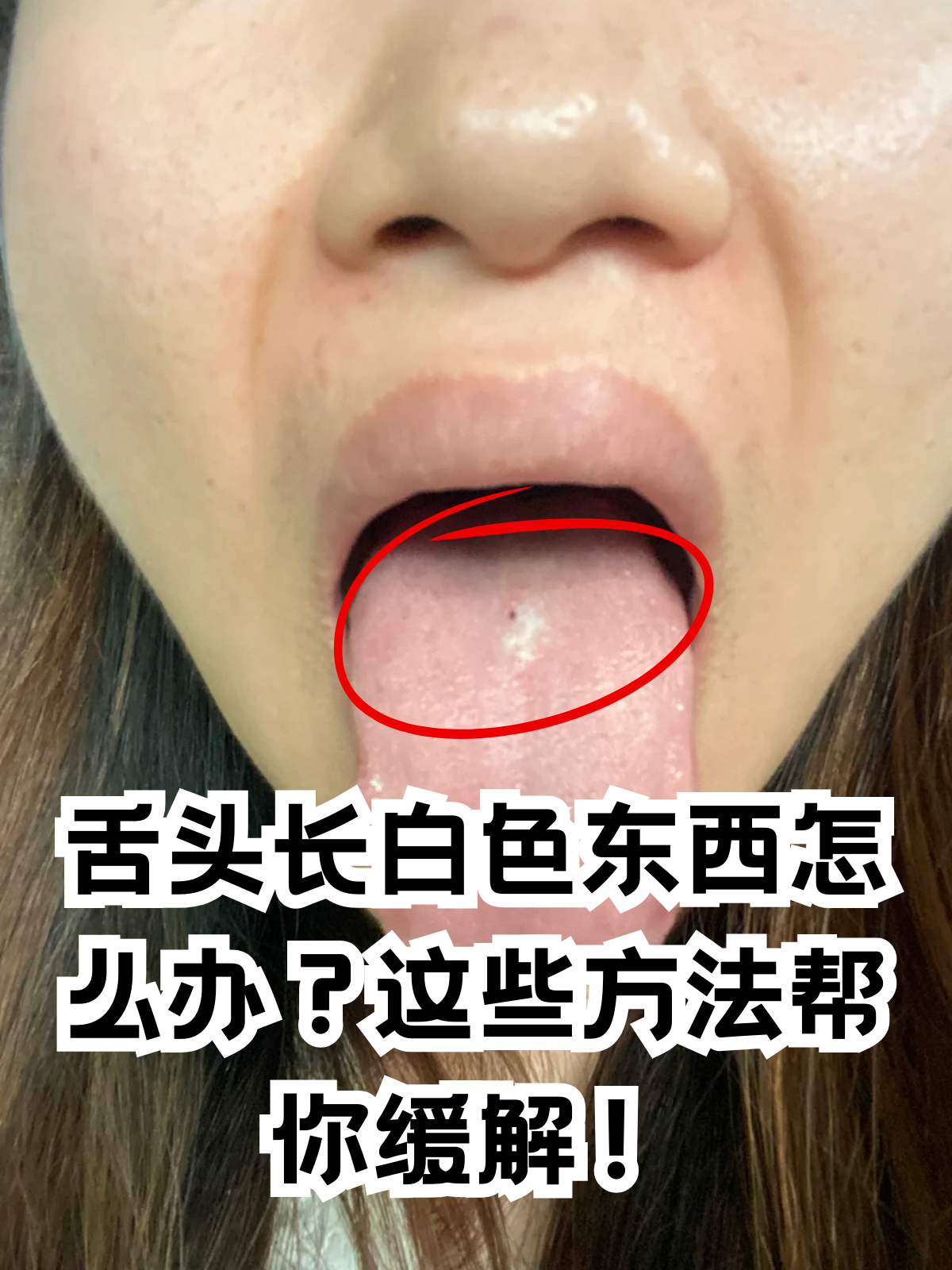 为什么舌苔发白