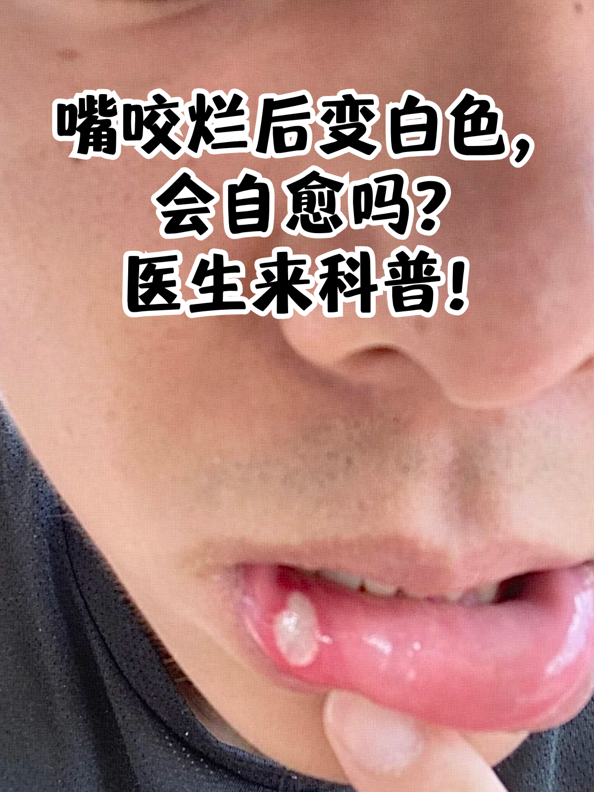 嘴唇为什么发白