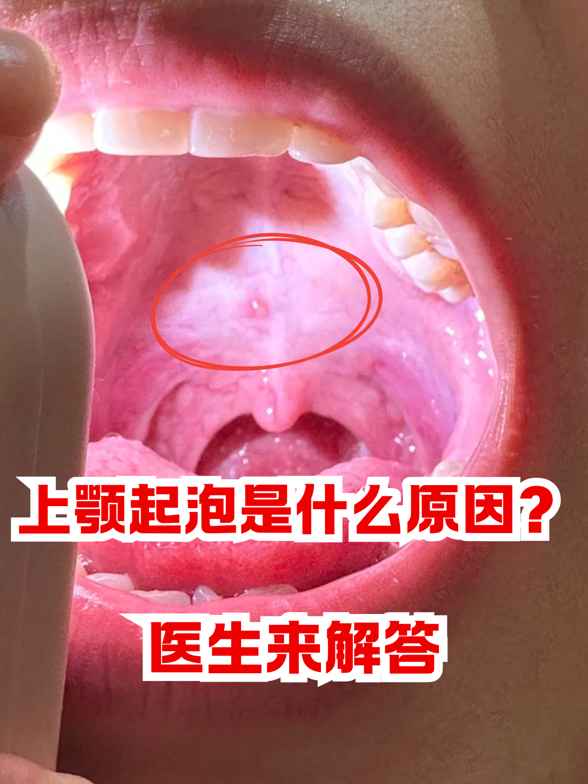 这小水泡究竟是从哪冒出来