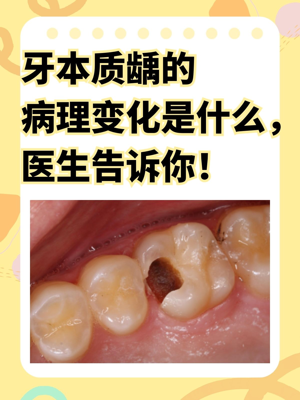 你是否曾注意过牙齿颜色的微妙变化?