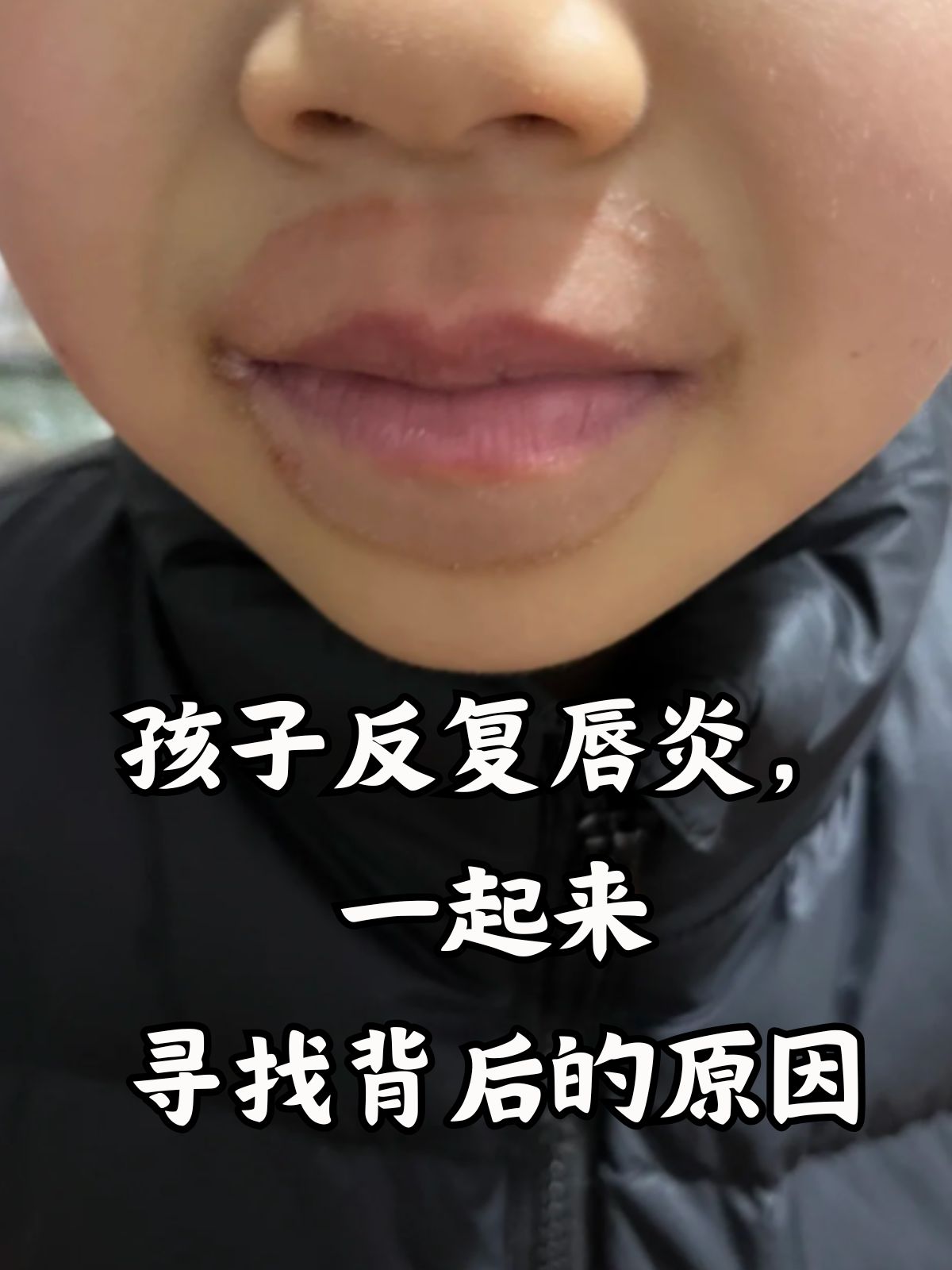 涂唇膏危害(涂唇膏后嘴唇起皮)
