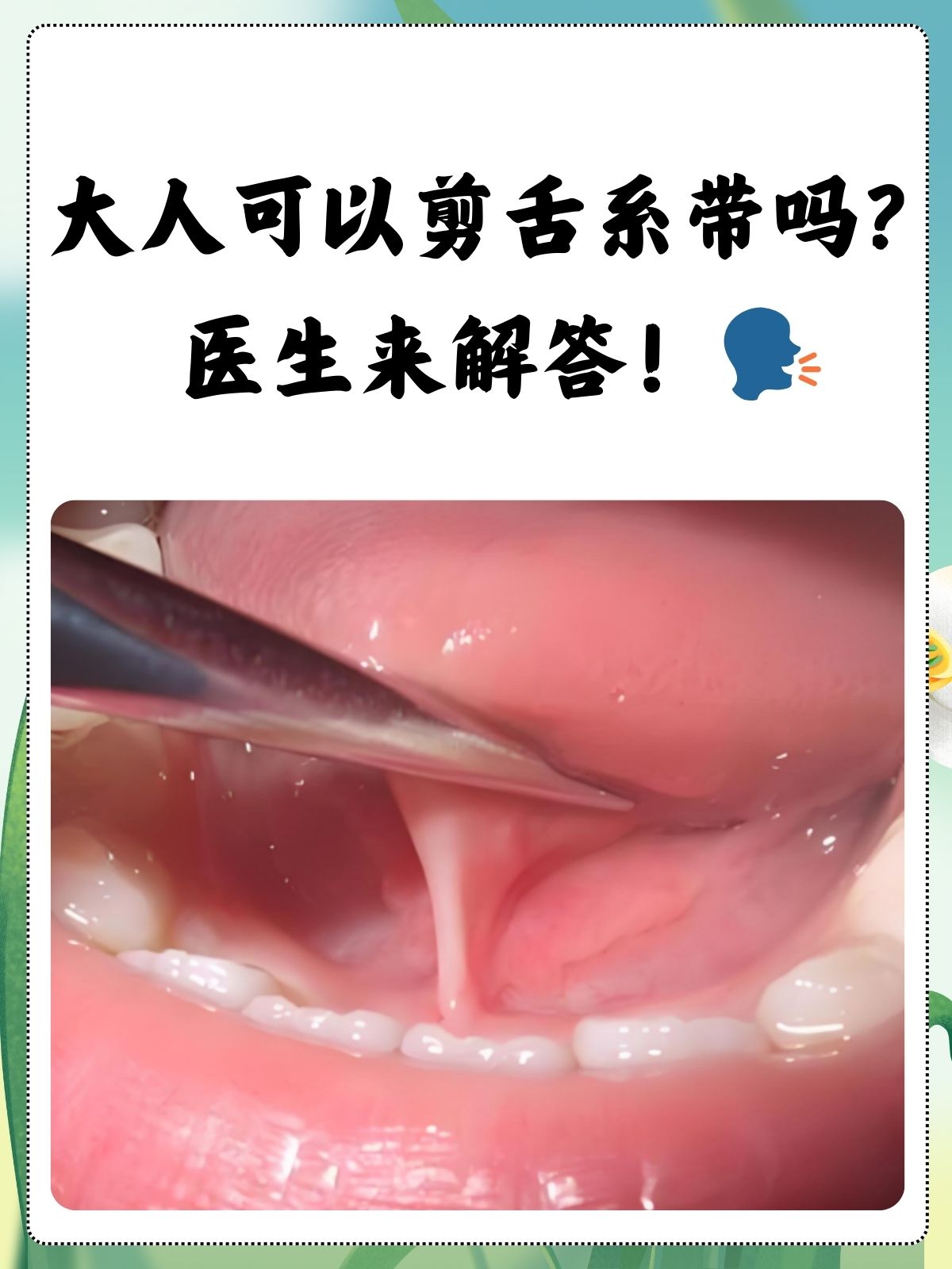 舌根紧贴软腭图片