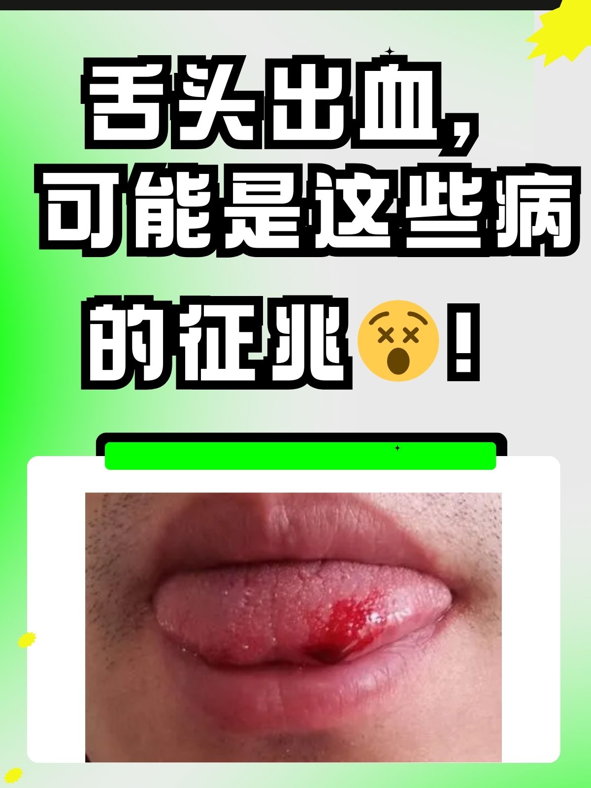 口腔出血的照片图片