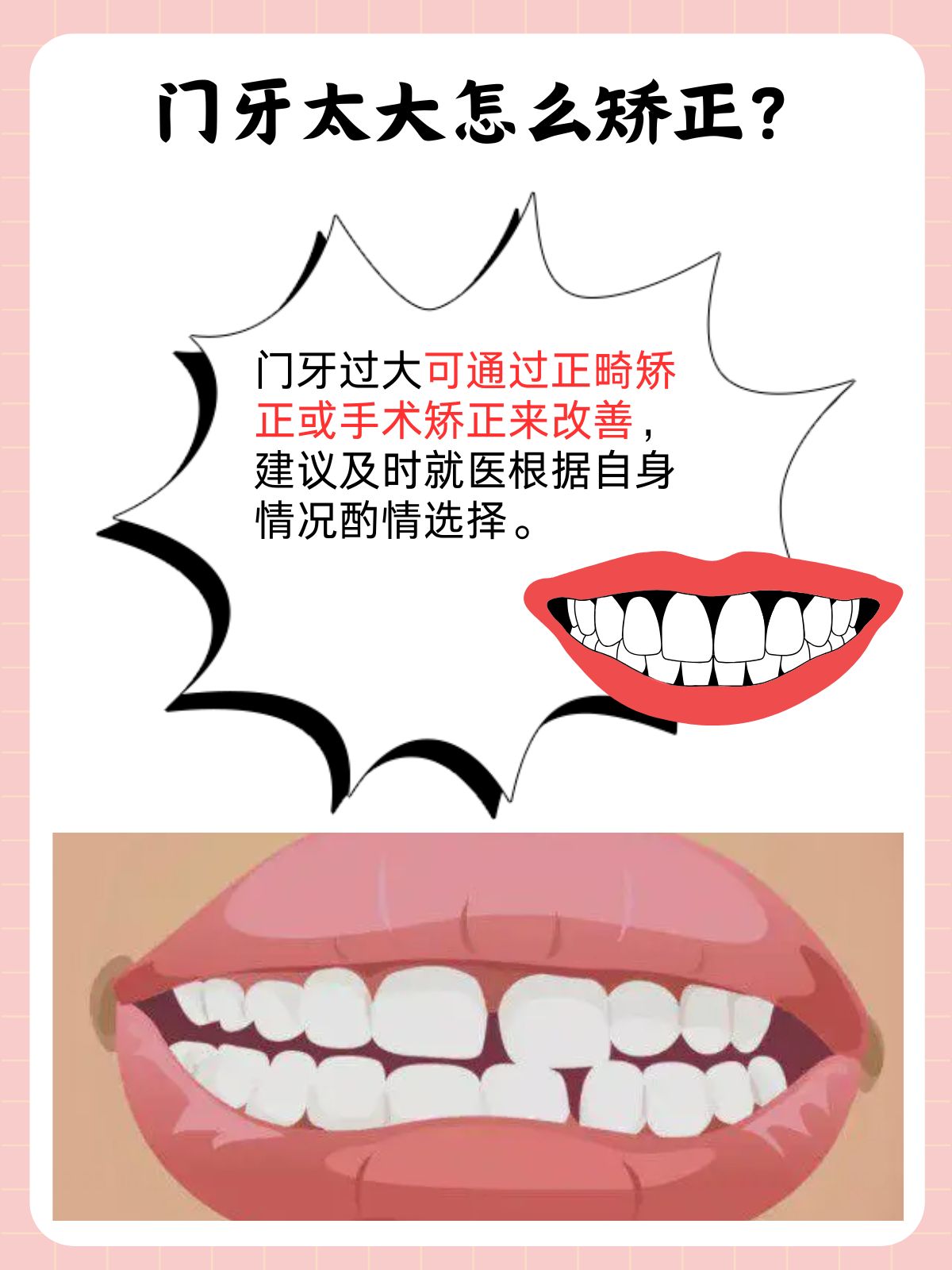 那么,门牙太大怎么矫正?