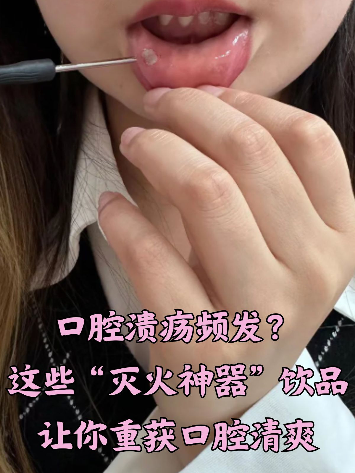 电动牙刷+震动+喷水+喷水使用后口腔溃疡怎么办