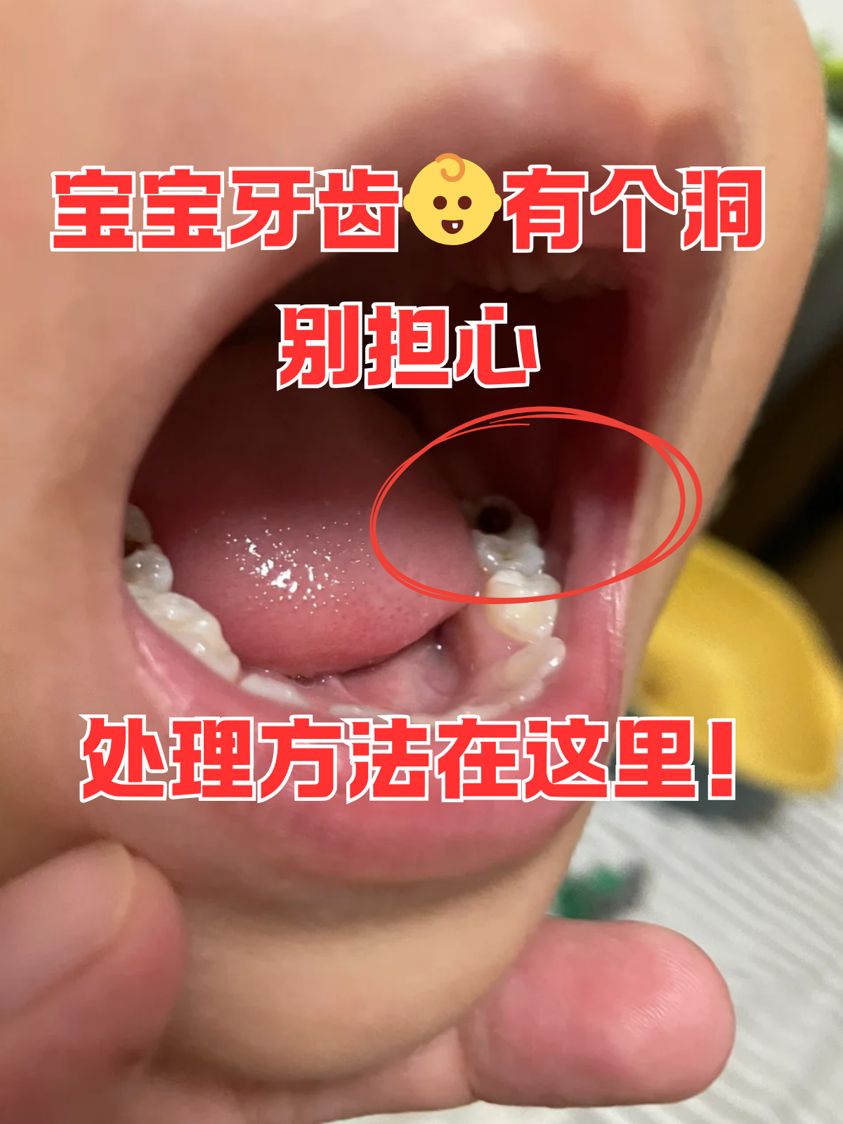 家有萌宝的家长们,是不是在给宝宝刷牙的时候,突然发现宝宝的牙齿上