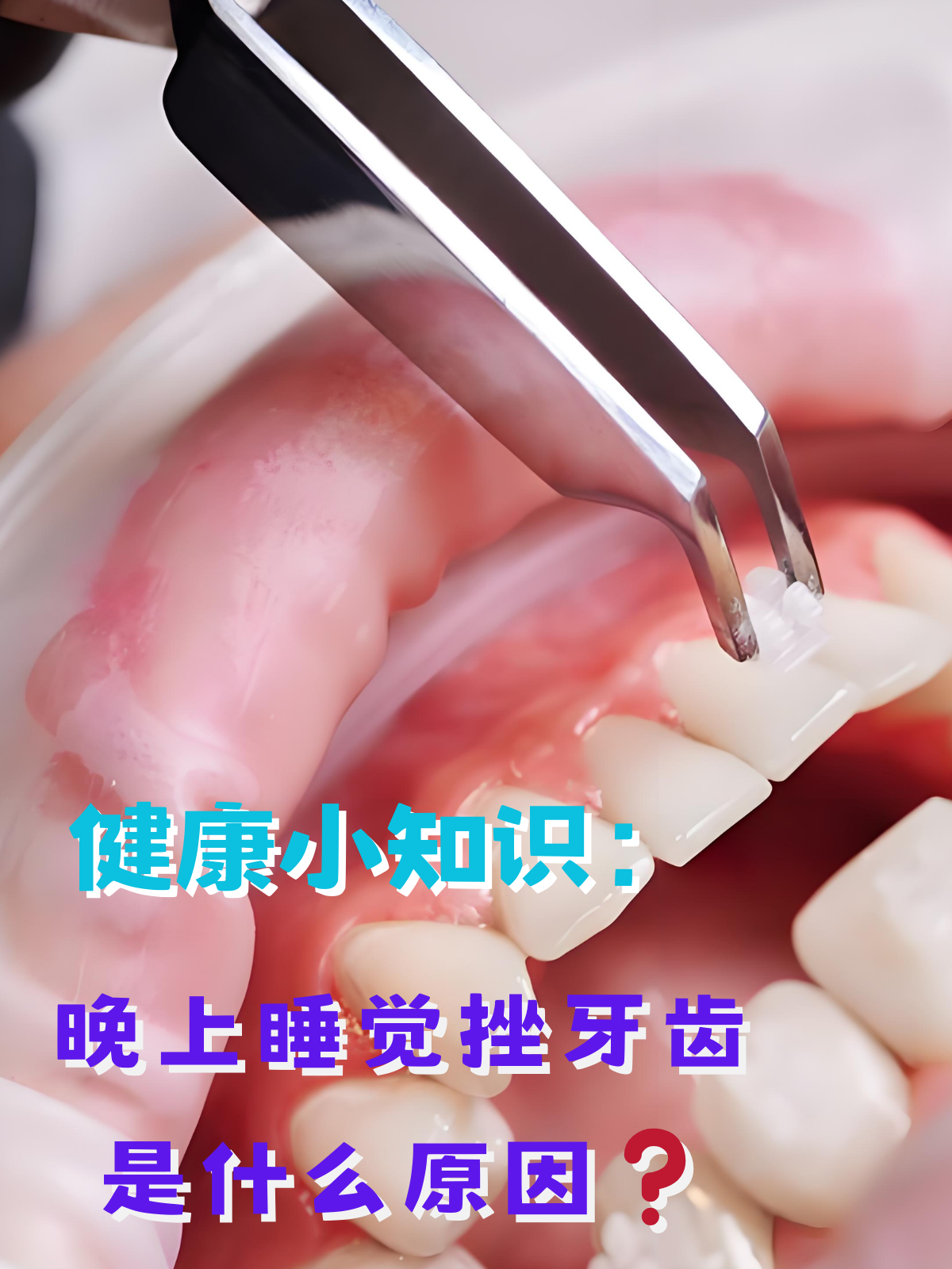 为什么晚上睡觉会磨牙说梦话为什么在线 为什么晚上睡觉会磨牙说梦话为什么在线