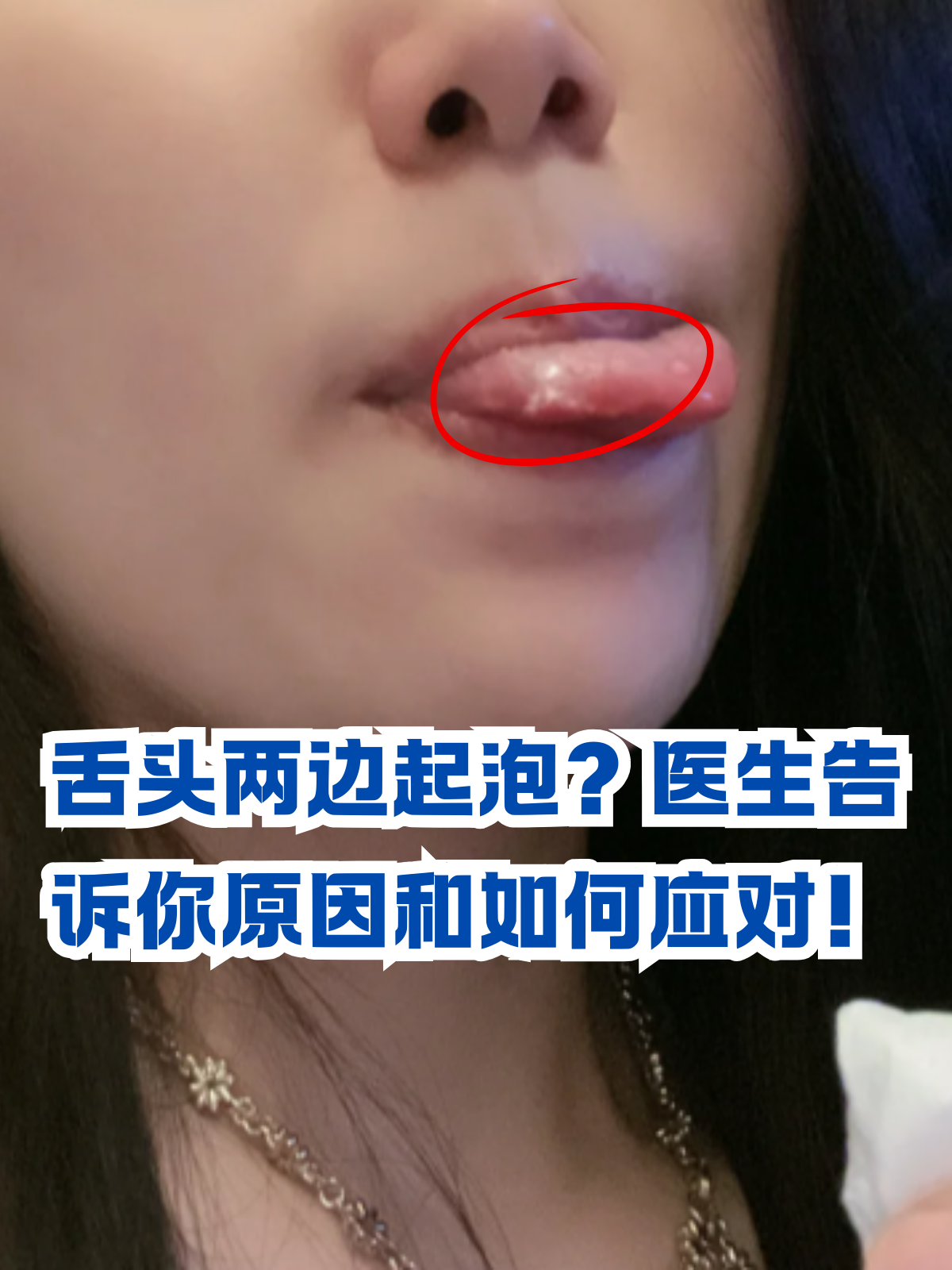 舌头作为品尝美食的重要器官,当出现不适时,往往会让人感到十分困扰