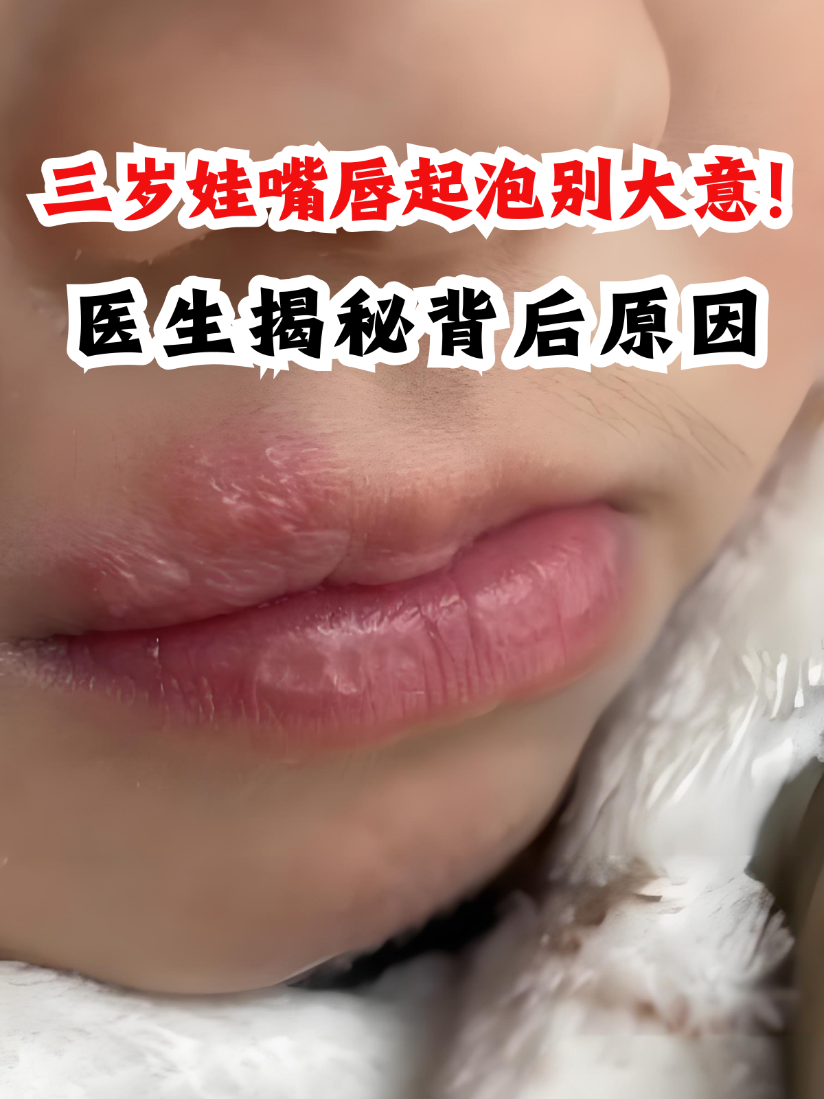 医生揭秘背后原因 各位家长朋友们,大家好!