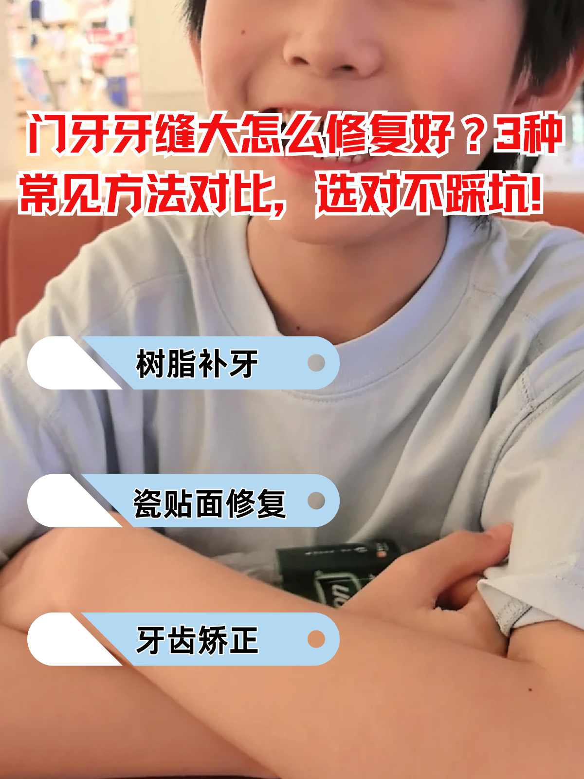 门牙牙缝大怎么修复好?3种常见方法对比,选对不踩坑!