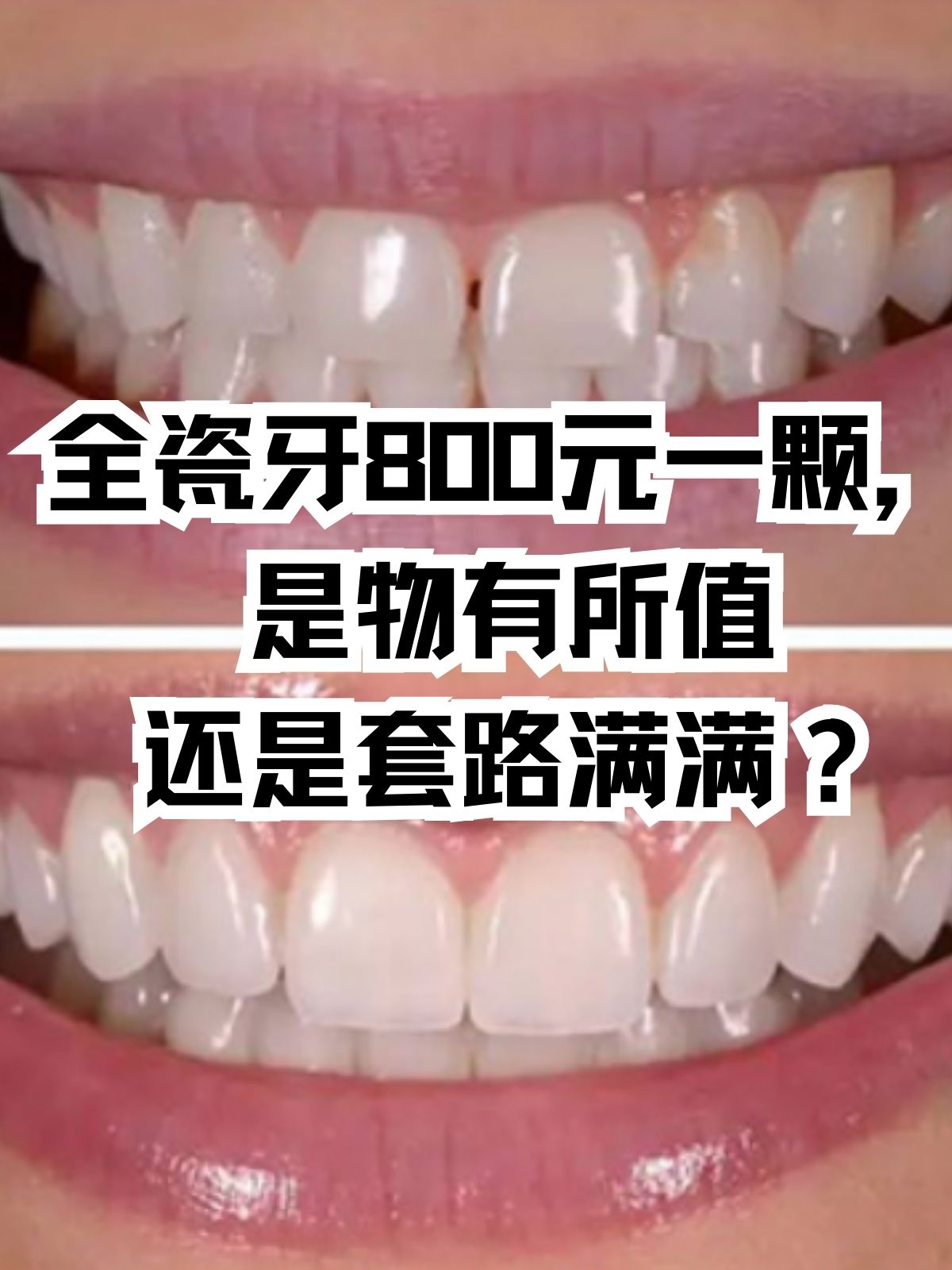 但在这诱人的价格背后,我们是否真的能收获一颗高品质的全瓷牙呢?