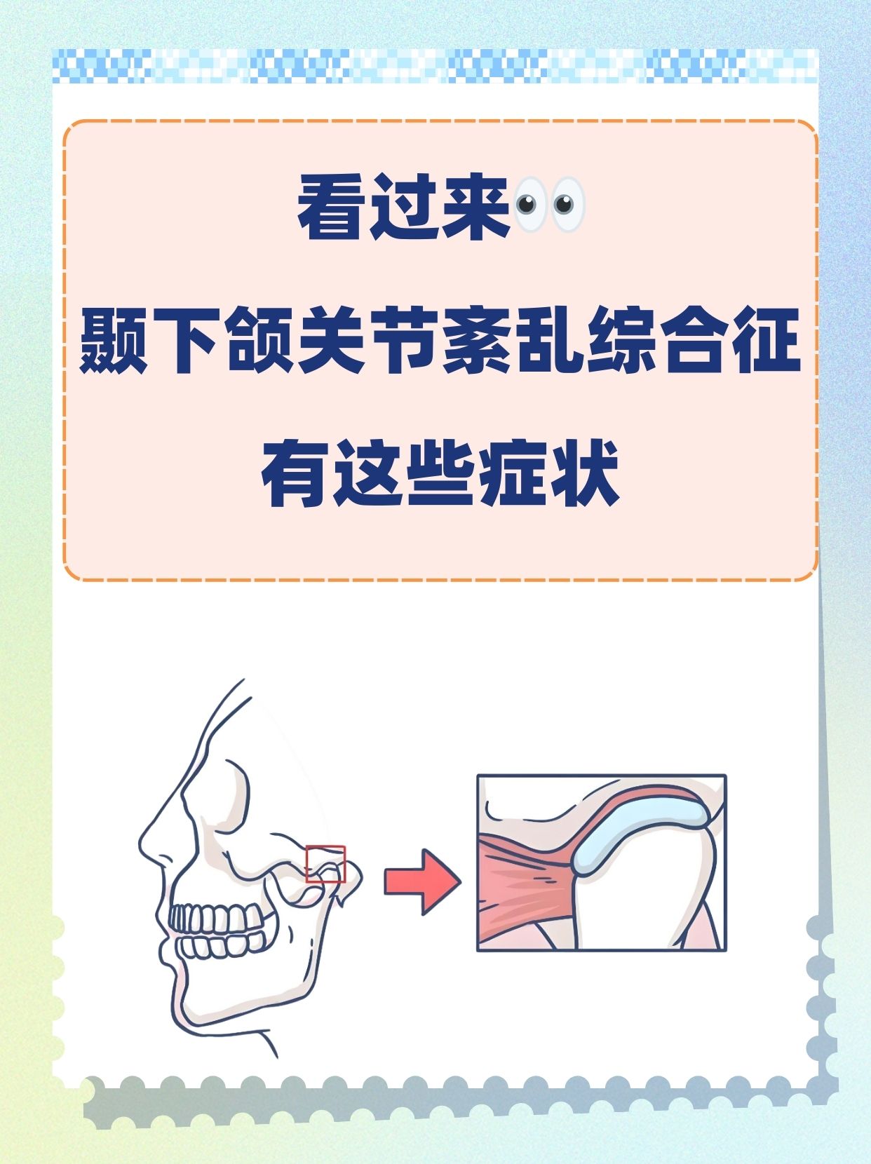 颞颌关节炎症状图片