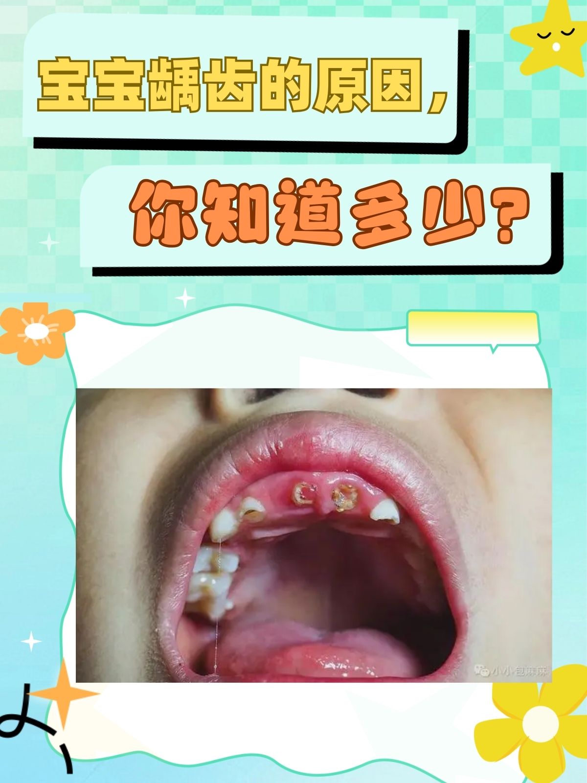 小孩子牙齿烂掉怎么办图片