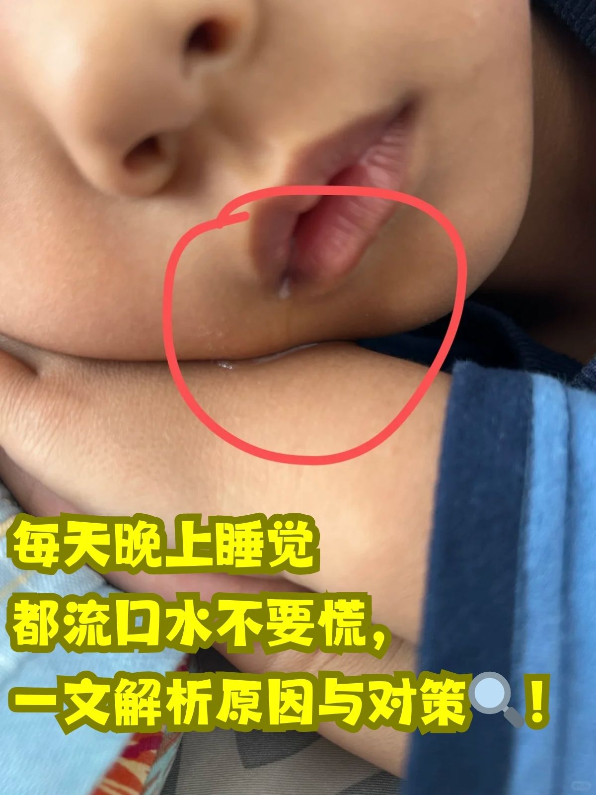 宝宝为什么总流口水的原因为什么在线 宝宝为什么总流口水的原因为什么在线