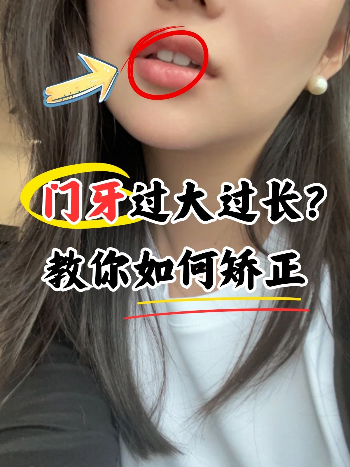 今天,我们要聊一个既常见又让人头疼的问题:门牙过大过长怎么办?