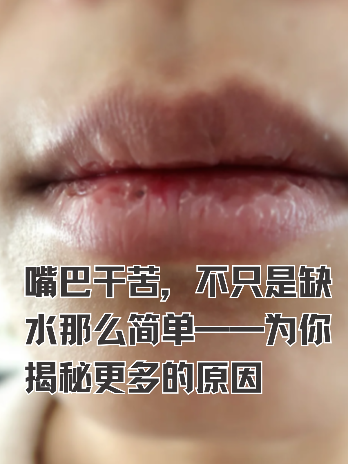 嘴里为什么发苦呢百科在线