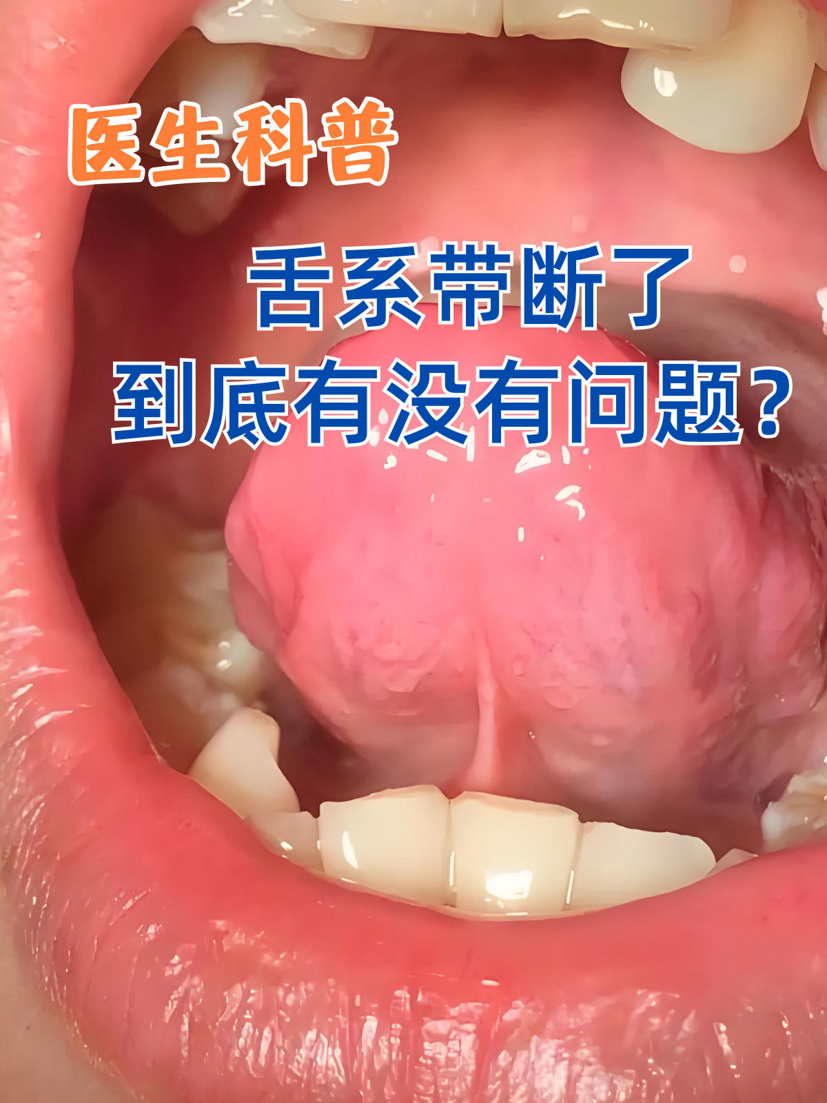 生活中难免会有一些意外状况,比如突然不小心咬到舌头,或者吃东西太