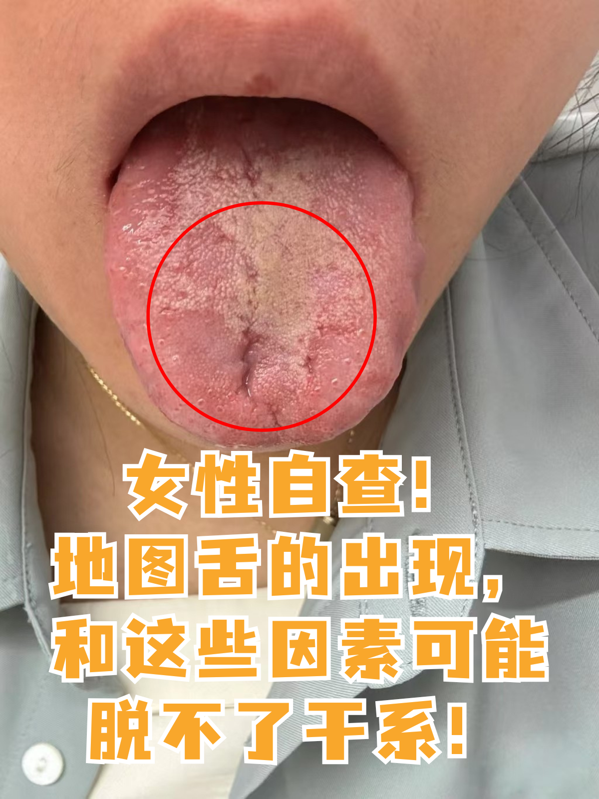 地图舌的出现,和这些因素可能脱不了干系!