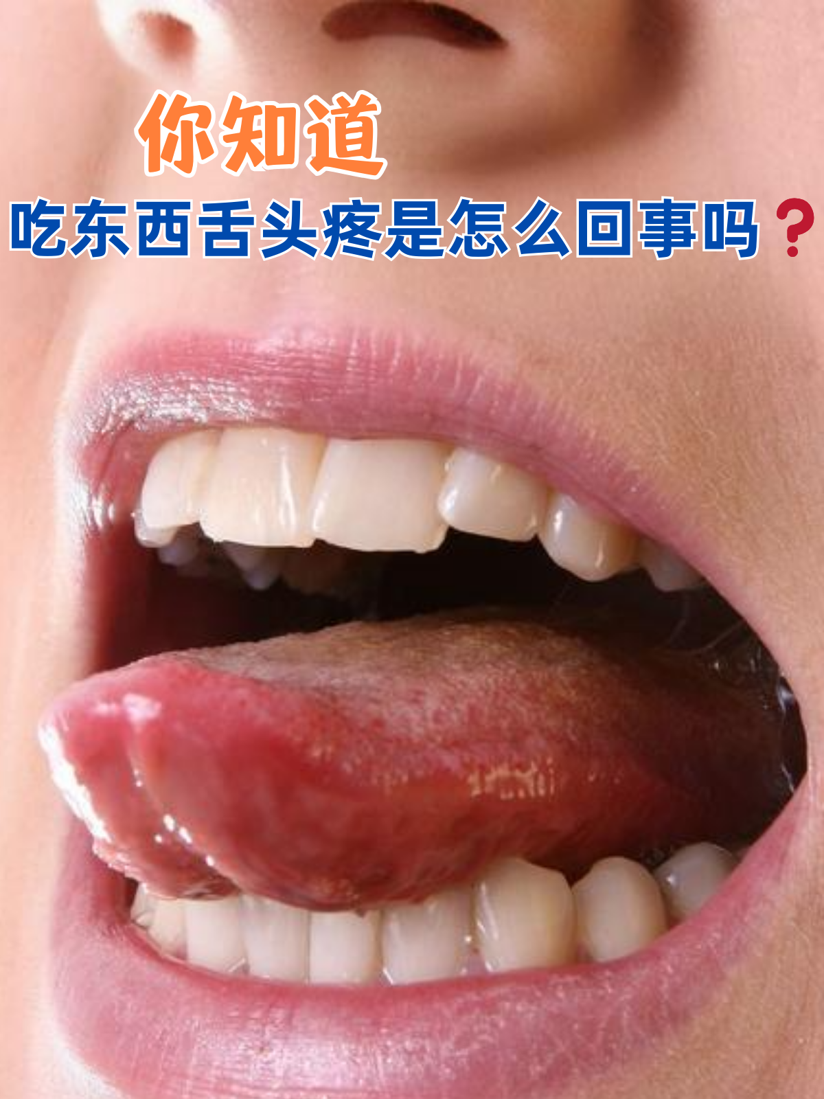 为什么会咬舌头