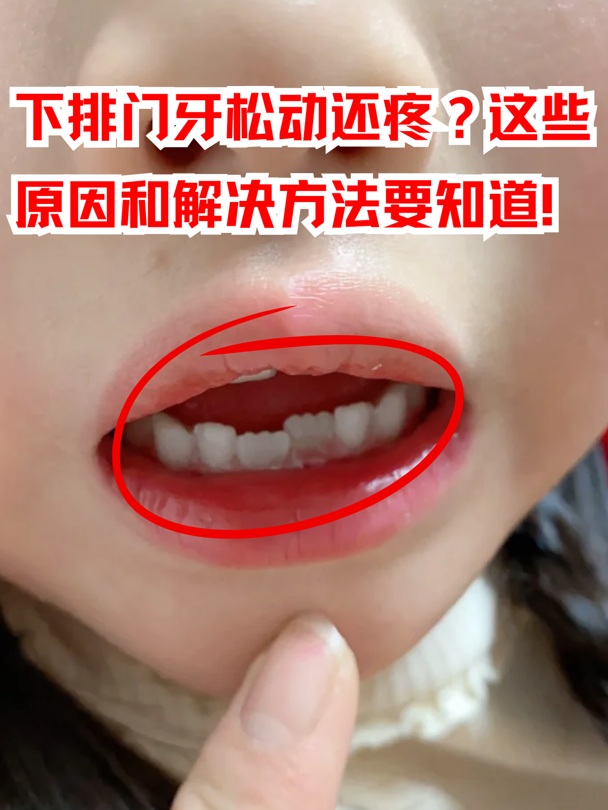 下排门牙松动还疼?这些原因和解决方法要知道!