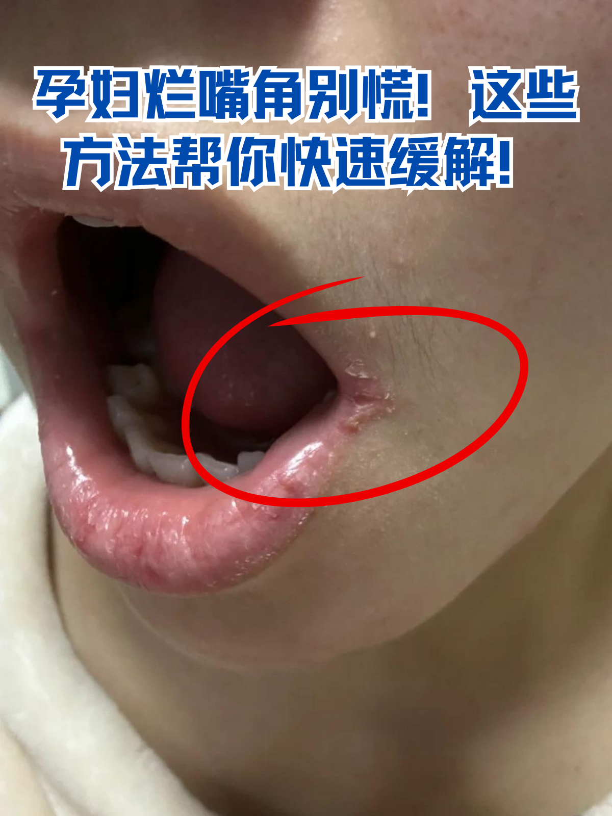这些方法帮你快速缓解!