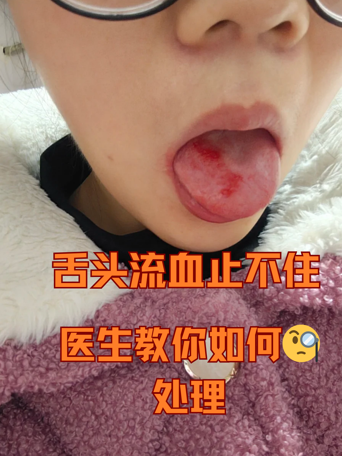 舌头为什么发麻 舌头为什么发麻