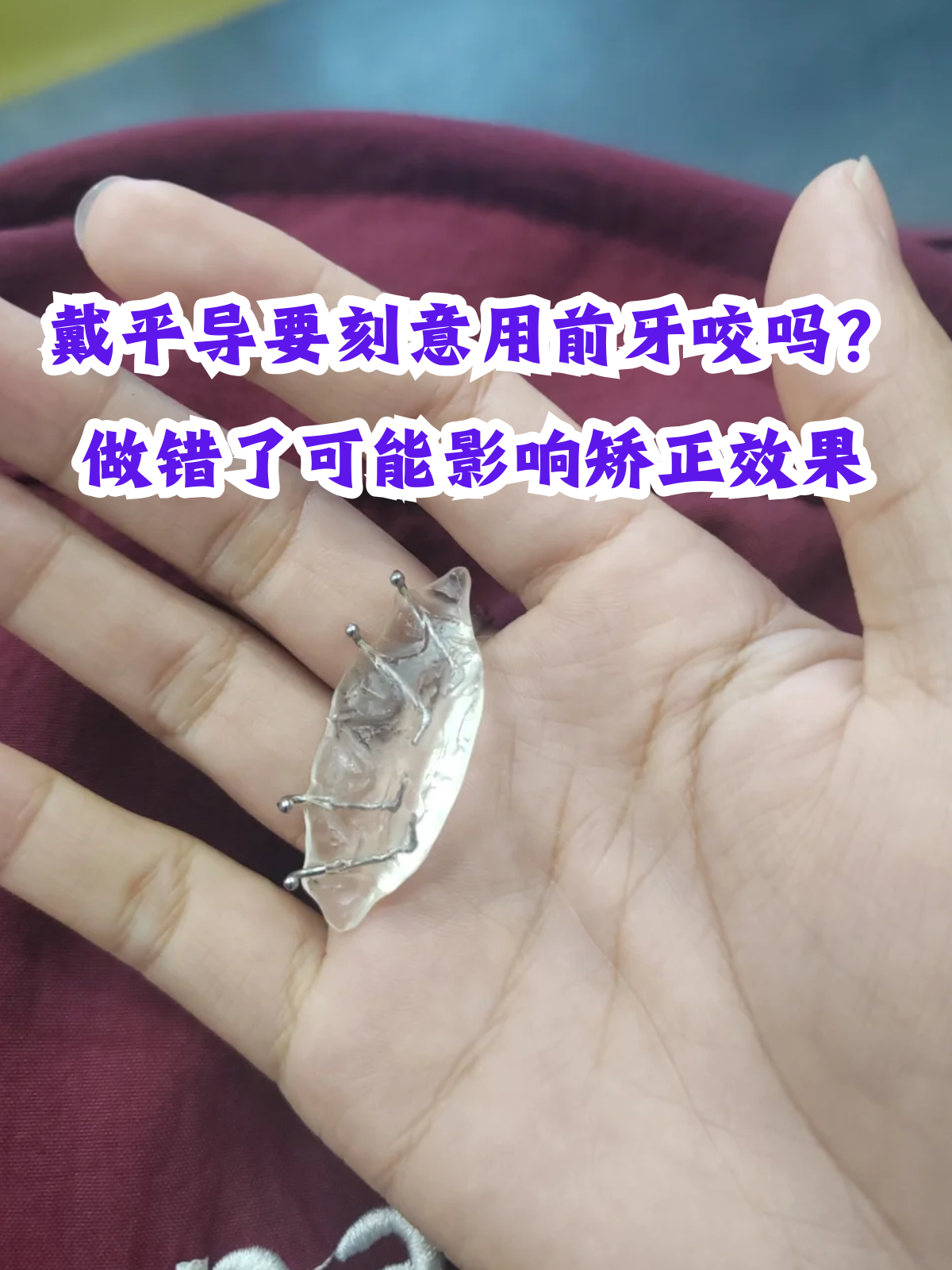 做错了可能影响矫正效果 平导(平面导板矫治器)作为矫正深覆合的常用