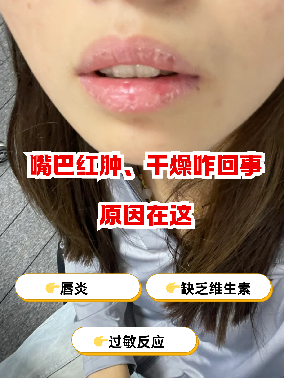 原因在这 嘴巴是我们品尝美食的"窗口",要是它突然变得红肿又干燥