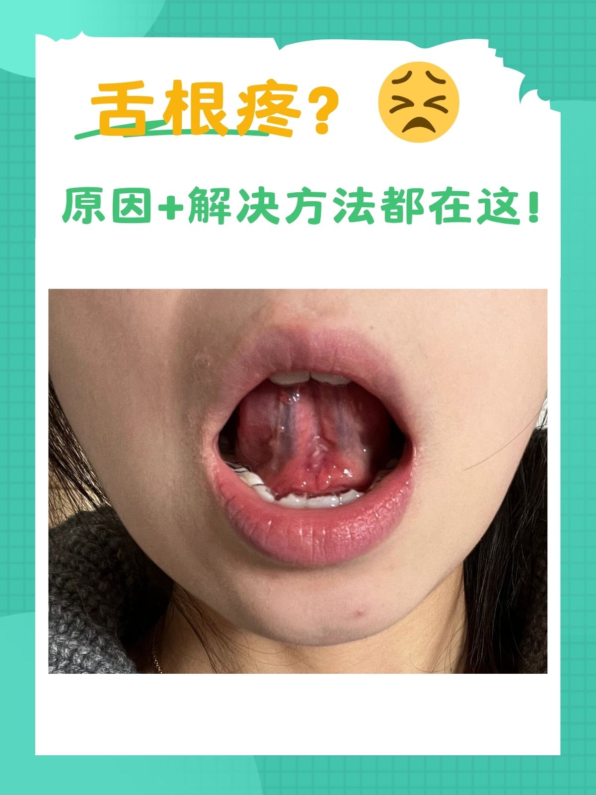 杨韵医生