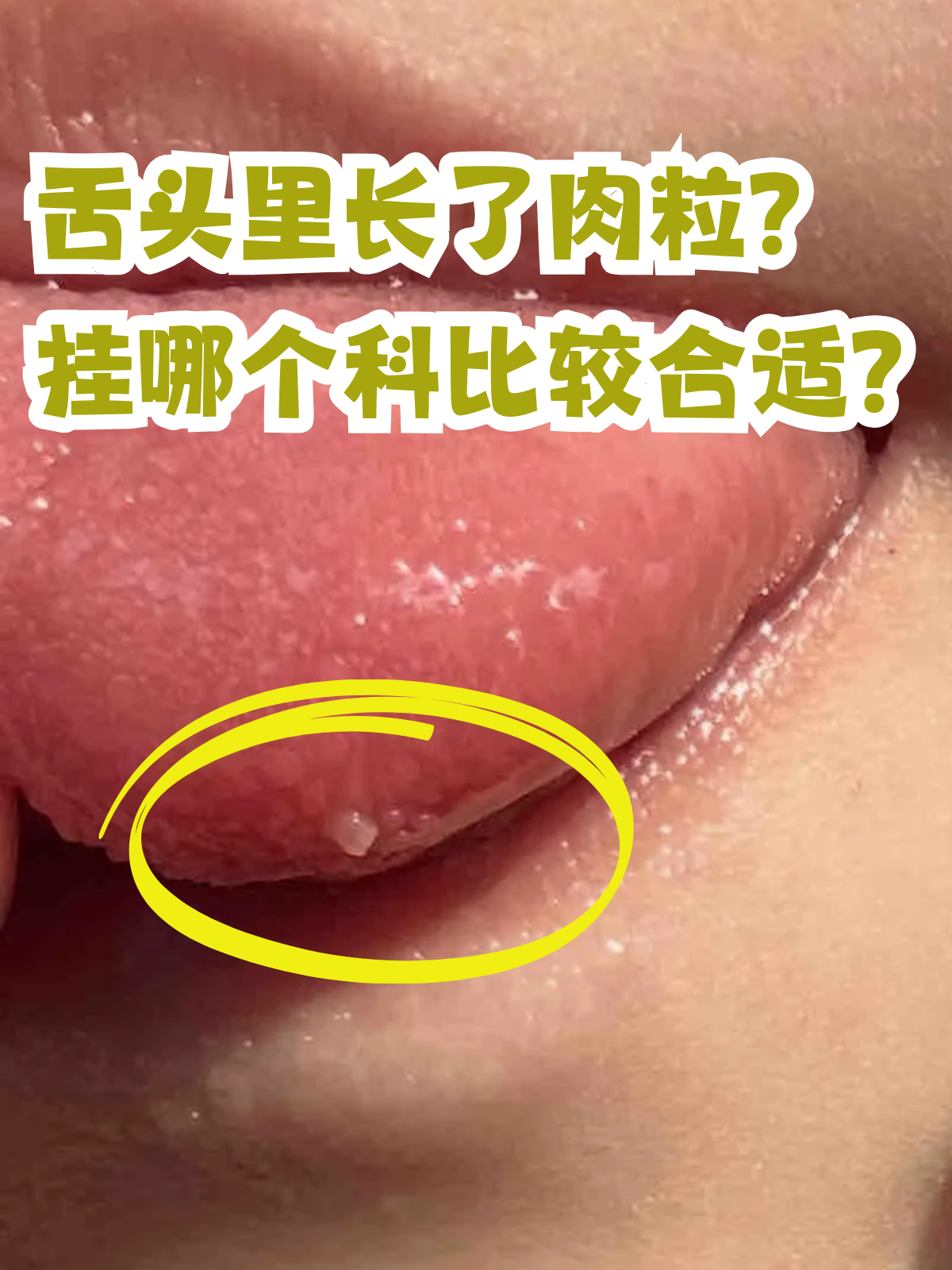 舌头作为口腔的重要组成部分,其健康状况直接