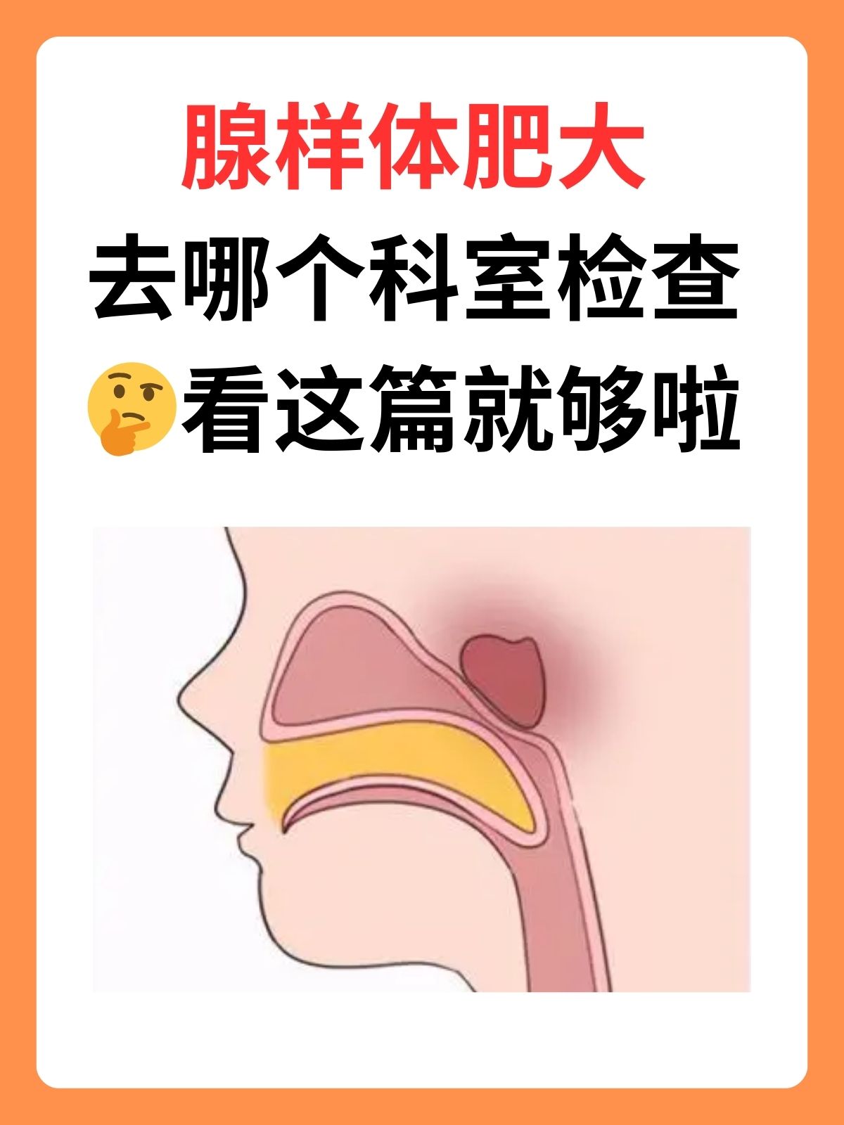 腺样体肥大去哪个科室检查看这篇就够啦 听说过没有,腺样体肥大可能