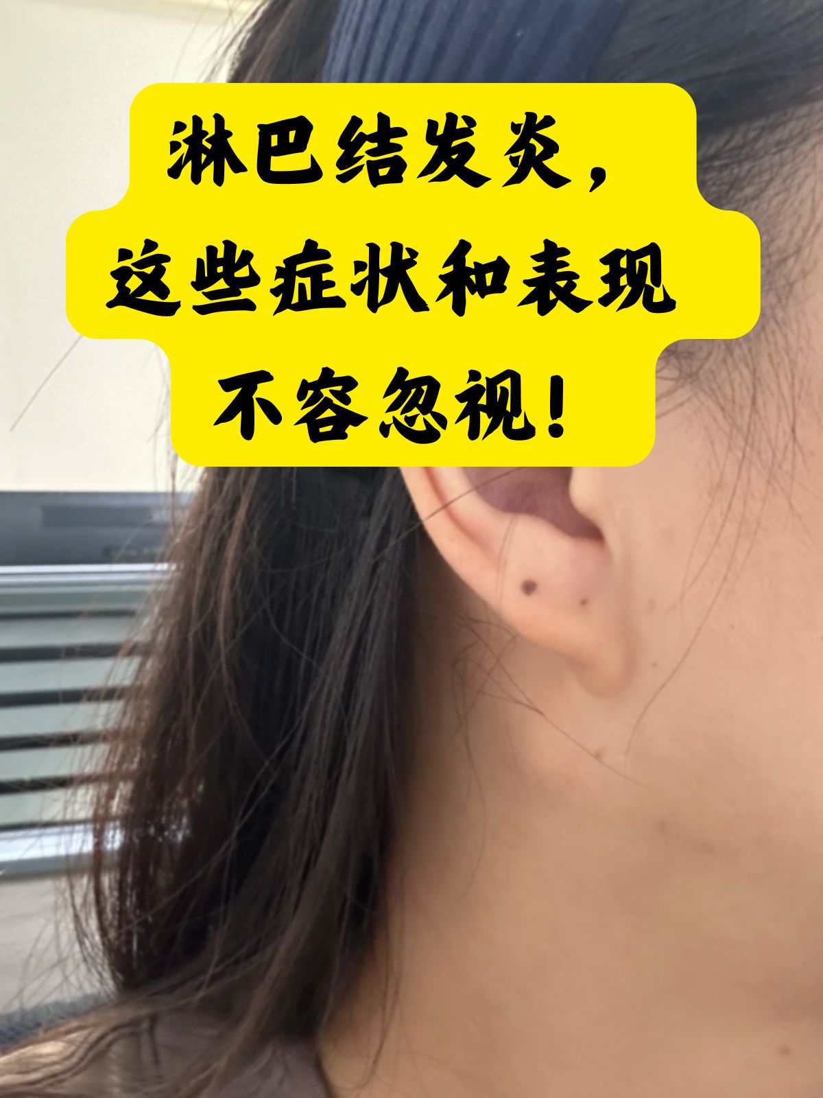 怎么会长淋巴结的原因为什么在线