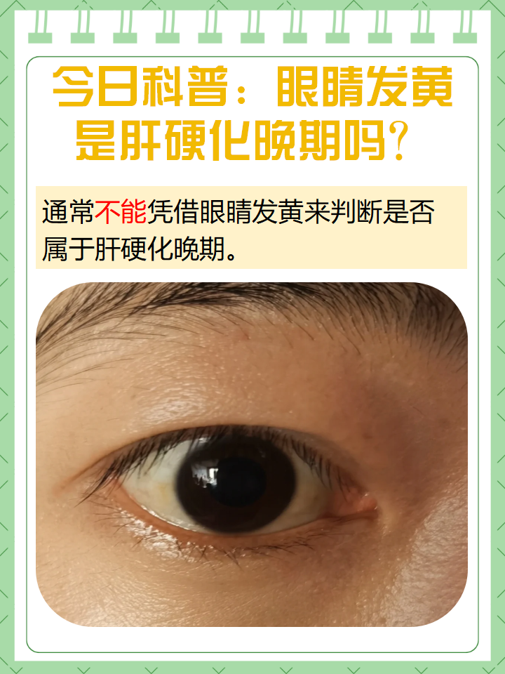 脸为什么发黄小孩百科在线