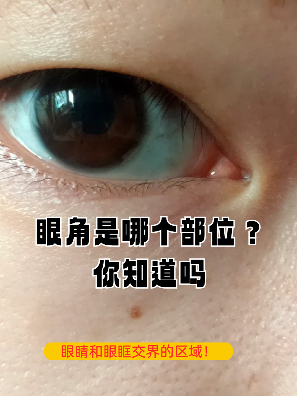 眼角是哪个部位?