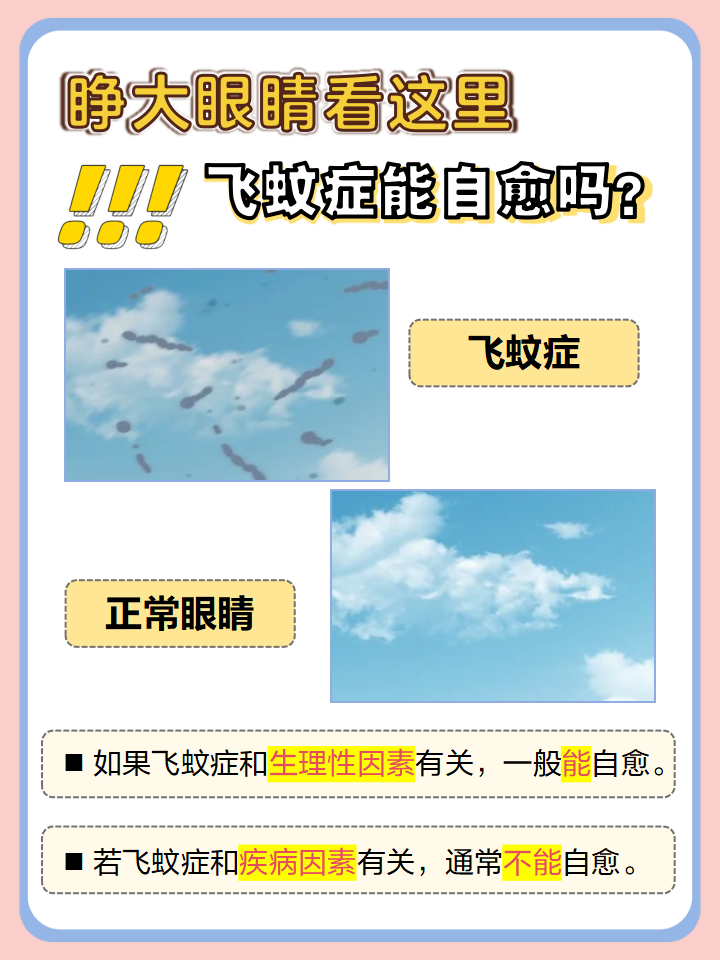 大家了解飞蚊症吗?