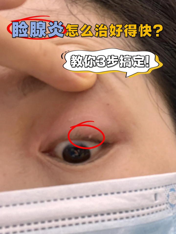 如果眼睫毛根部附近出现硬结,红肿范围弥散,摸起来很痛