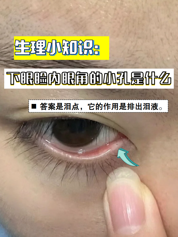 其实是眼睛的一个重要结构