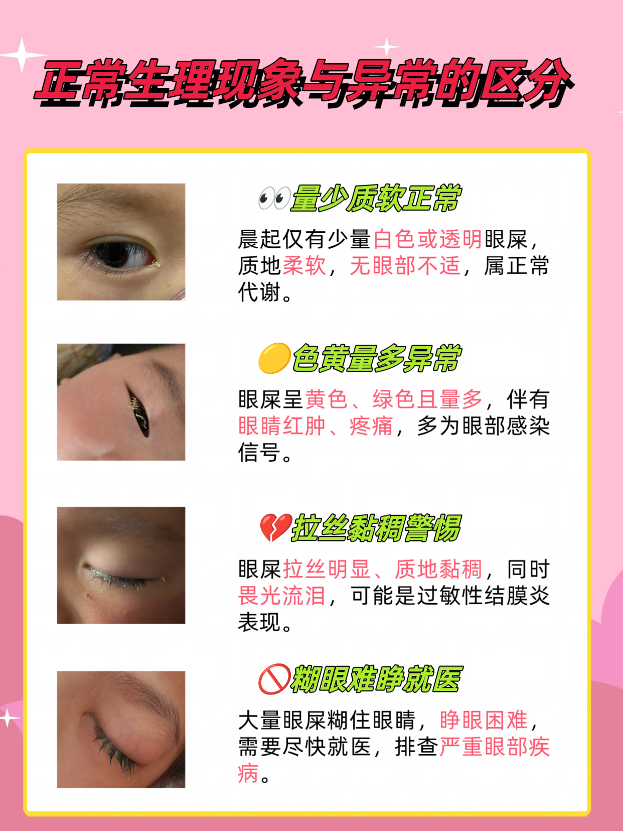 为什么眼睛总是有眼屎怎么办为什么在线 为什么眼睛总是有眼屎怎么办为什么在线