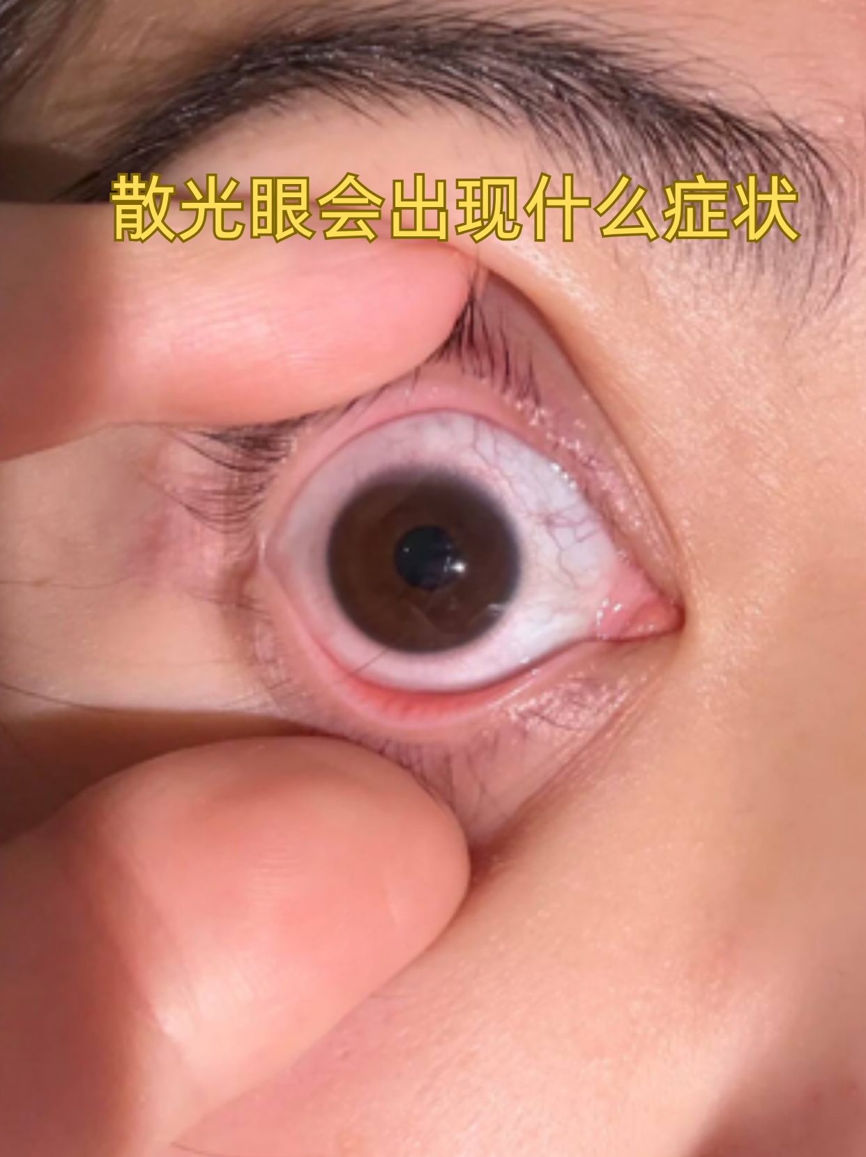 很多人以为只是"看东西模糊",其实症状远不止这么简单