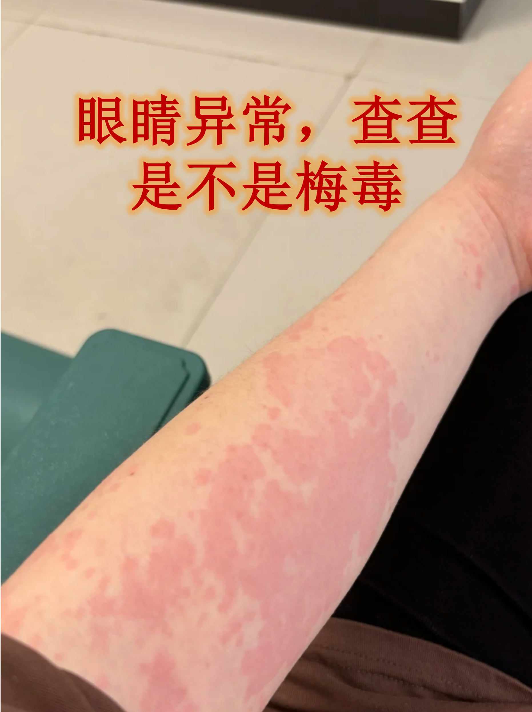  疫情发生的症状表现(疫情 发生)