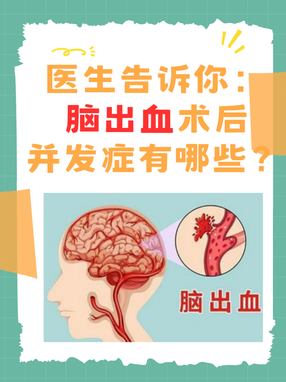 脑出血海报绘画图片图片