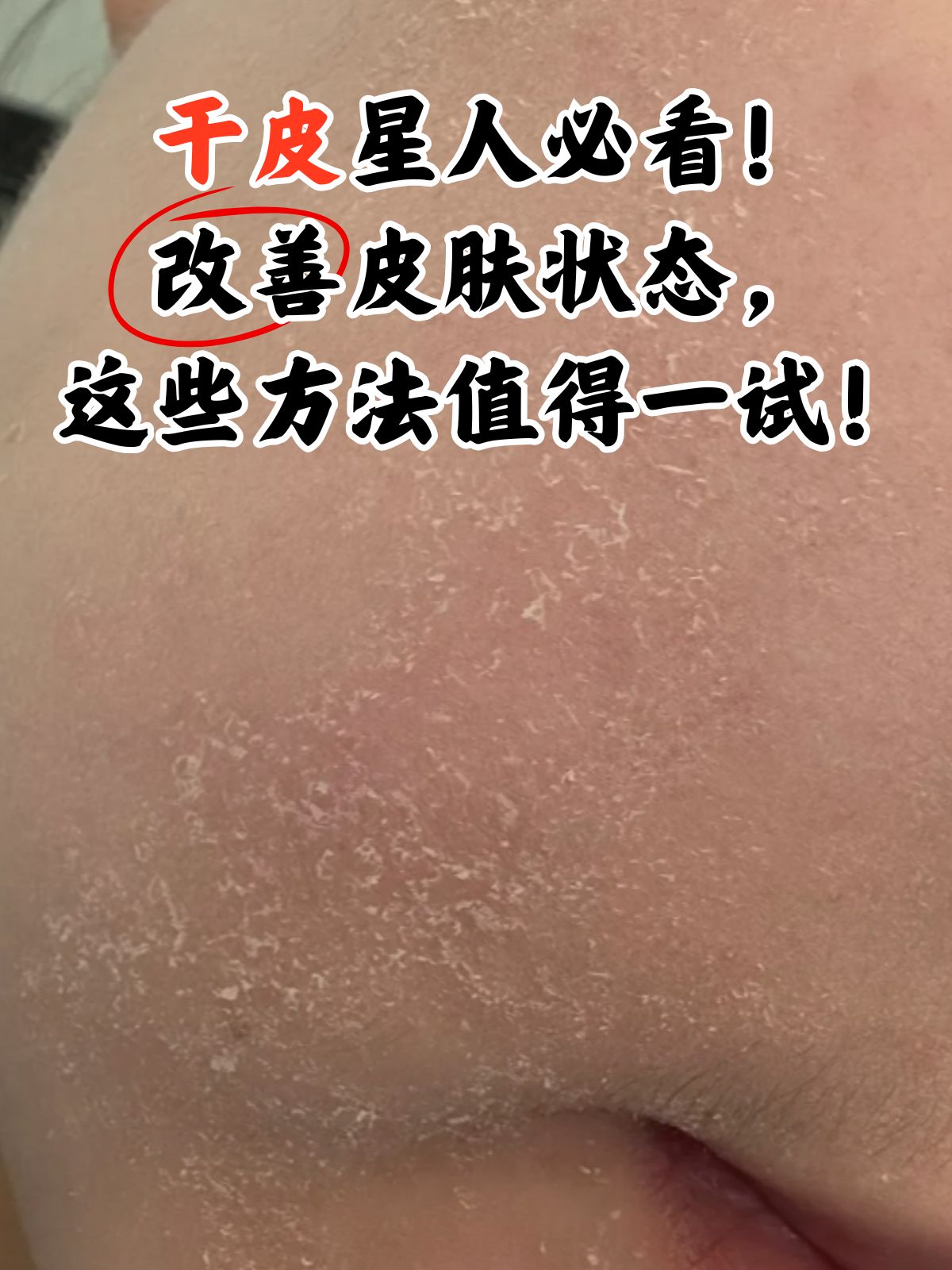 改善皮肤状态,这些方法值得一试!