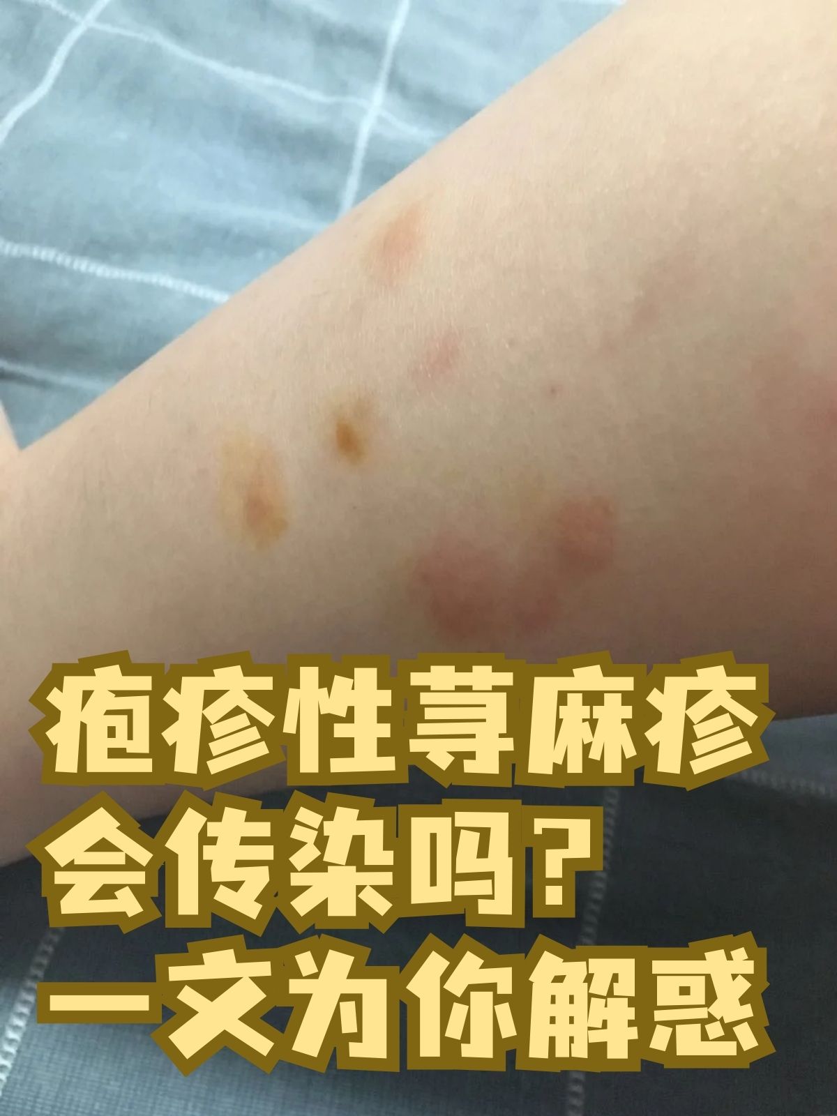  现在是不是有什么传染病(中国现在有什么传染病)