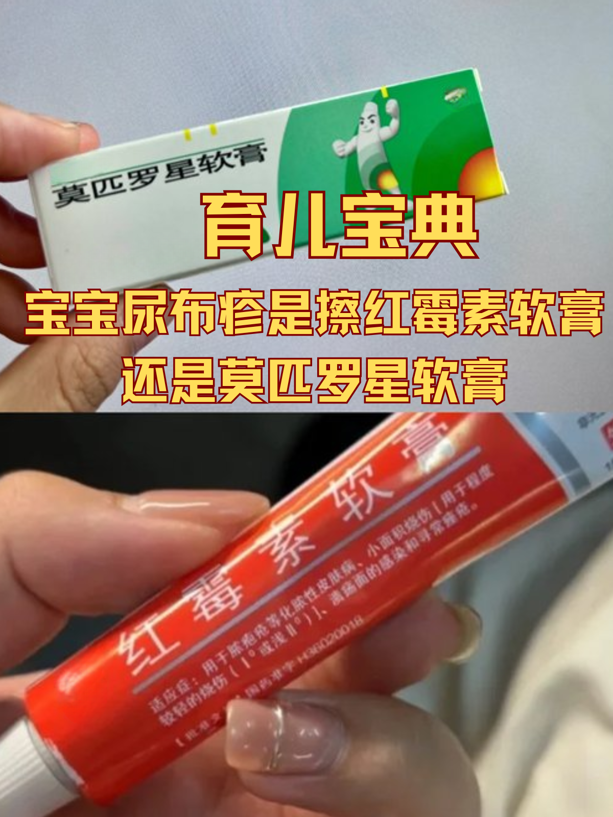 育儿宝典:宝宝尿布疹是擦红霉素软膏还是莫匹罗星软膏