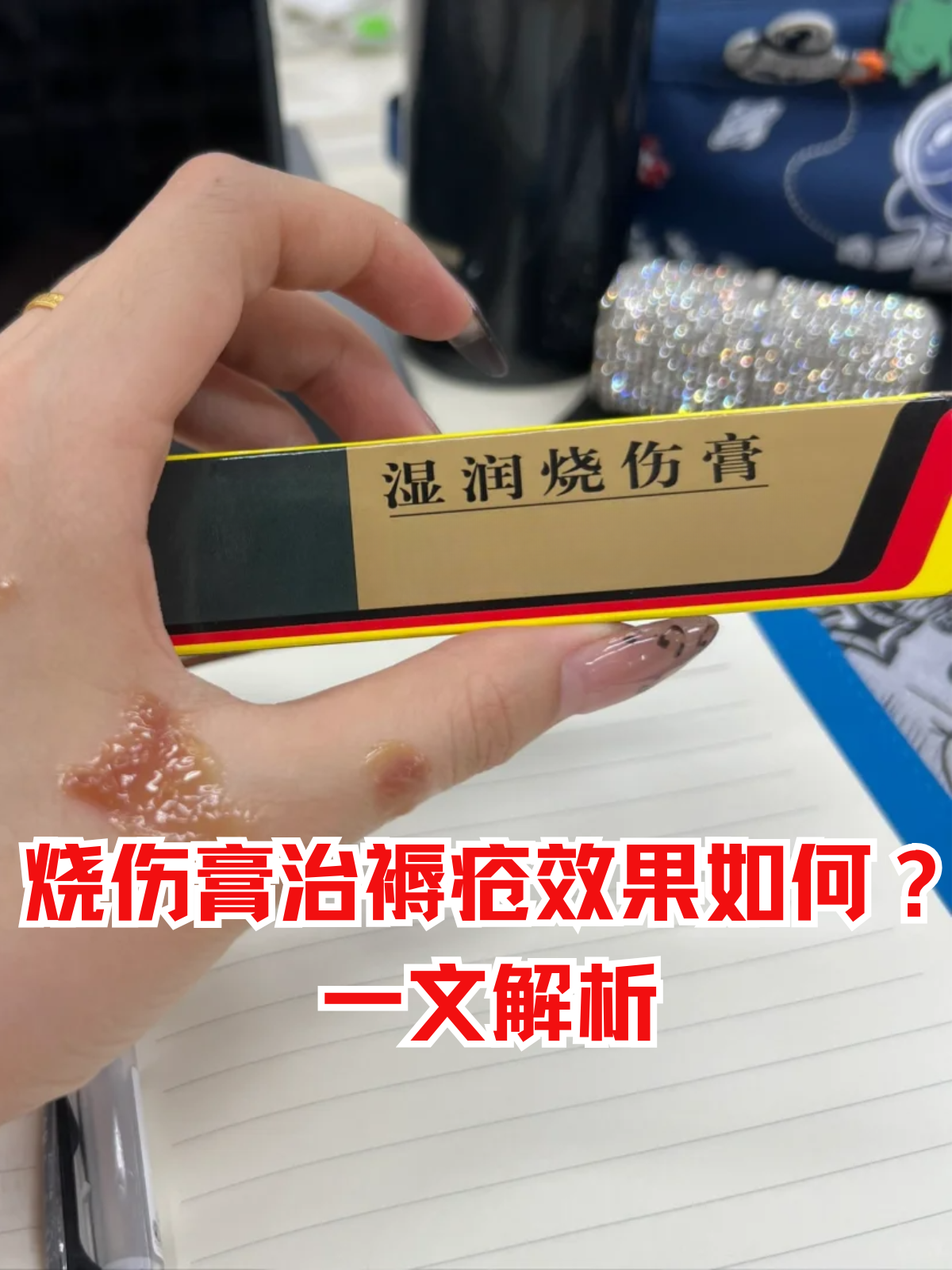 烧伤膏作为治疗烧烫伤的常用药,其主要功效为清热解毒,消肿止痛,生肌