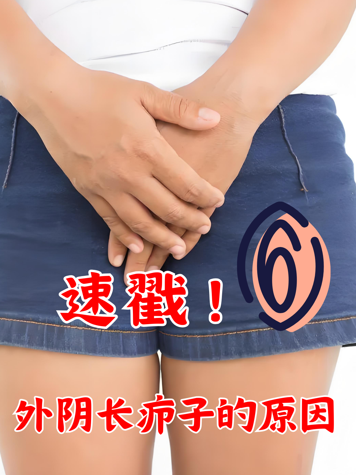 炎女性阴囊毛囊炎的症状阴部毛囊炎阴部火疖子女性私处长个脓肿图片